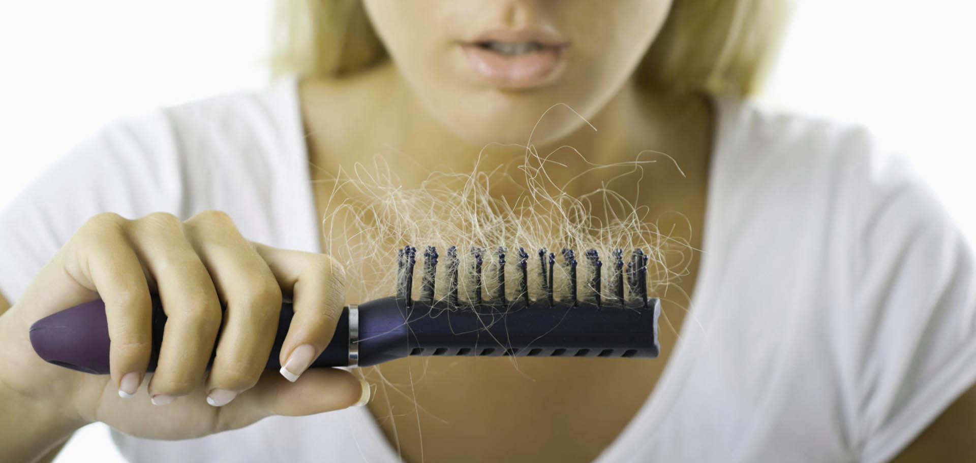 Prp Hair Loss Treatment Portland