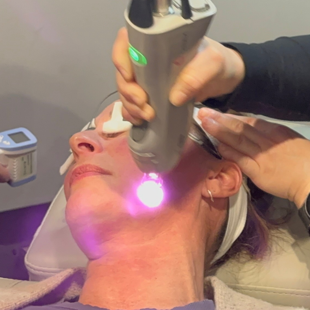 Laser Hair Removal