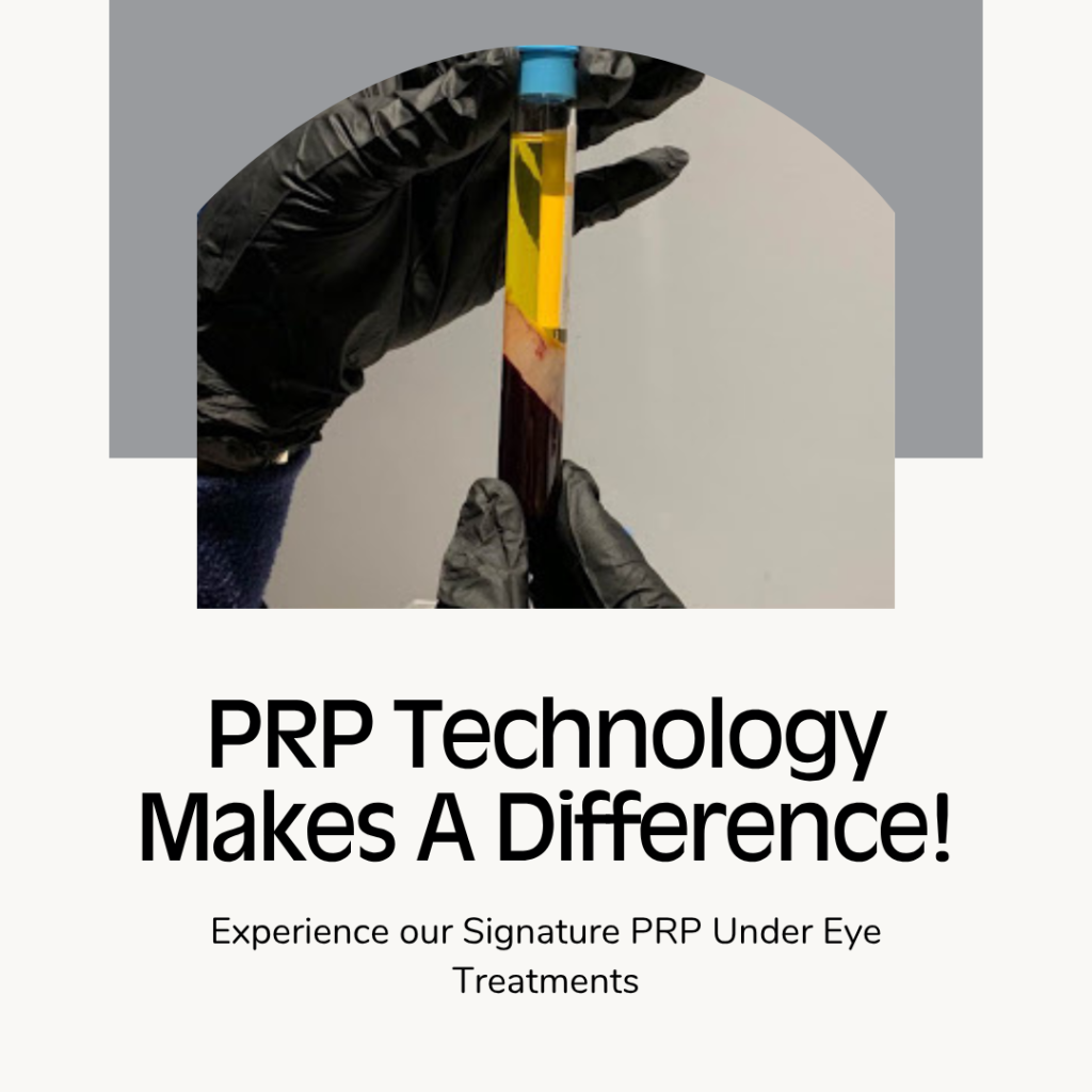 PRP Facial Rejuvenation